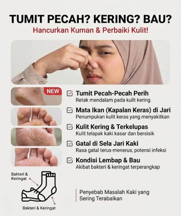 Masalah Tumit Pecah dan Kasar