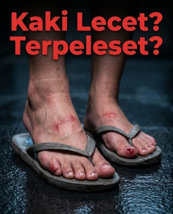 Masalah Sandal Wanita