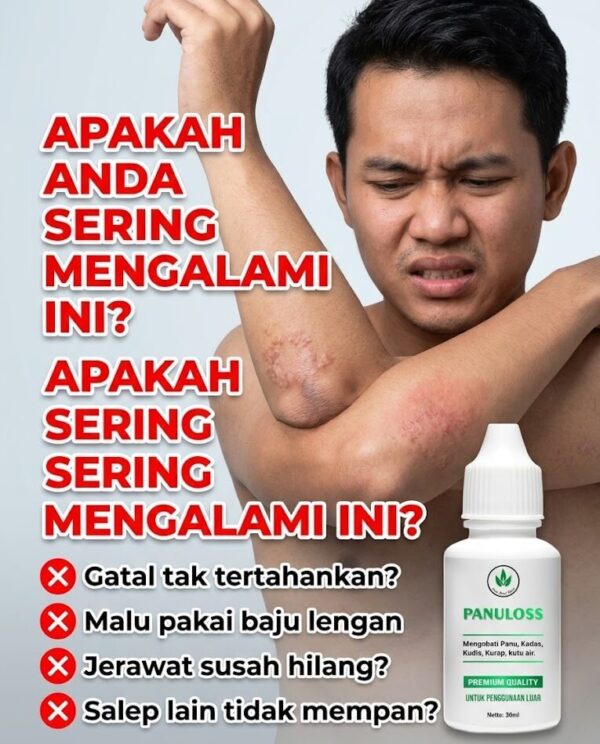 Masalah Panu Gatal