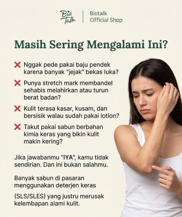 Masalah Kulit Stretchmark