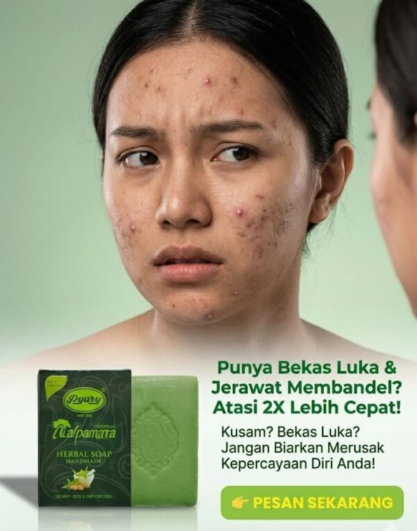 Masalah Kulit Kusam