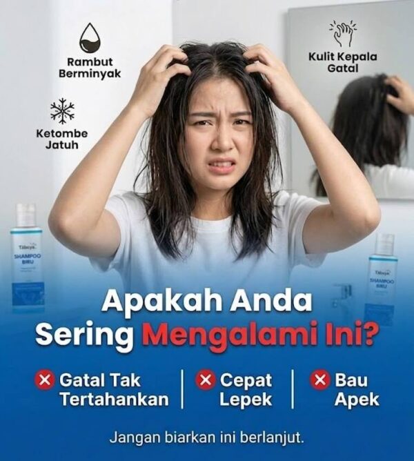 Masalah Rambut Ketombe Lepek
