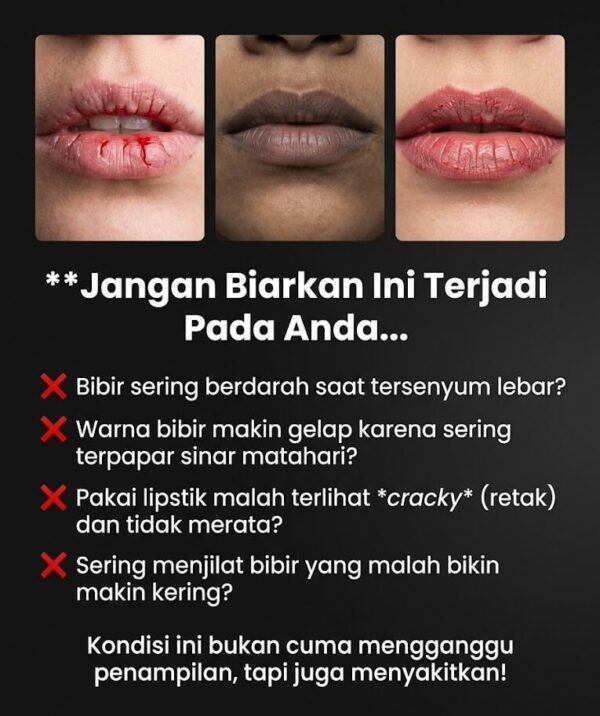 Masalah Bibir Kering