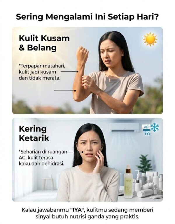 Masalah Kulit Kusam dan Belang