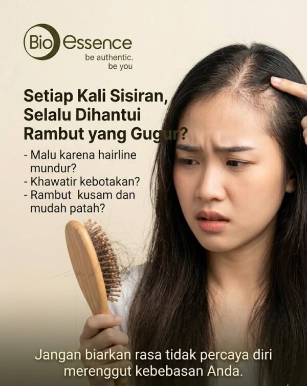 Masalah Rambut Rontok