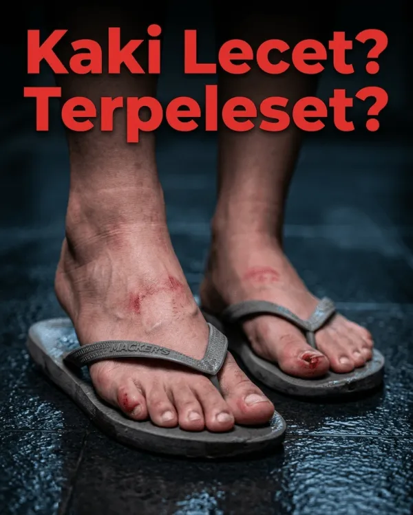 Masalah Sandal Wanita