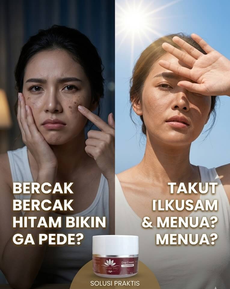 Masalah Kulit Kusam Flek Hitam