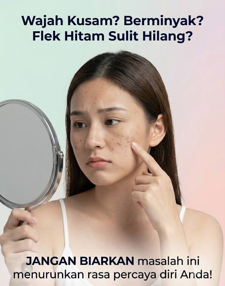 Masalah Wajah Kusam dan Flek
