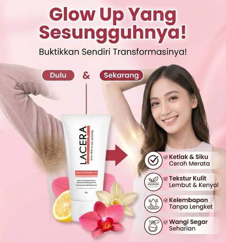 Keunggulan Lacera