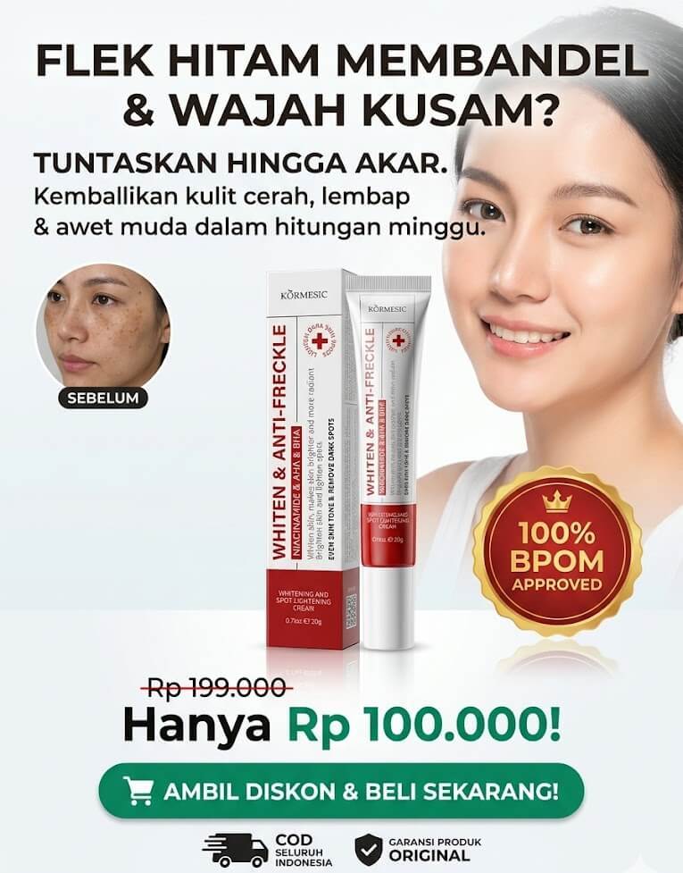 Whitening Freckle Cream